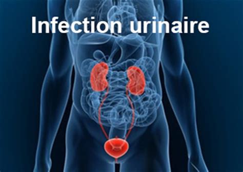 sodomie infection urinaire|Les IST et la sodomie, quels risques